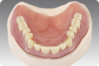 レジン床 義歯